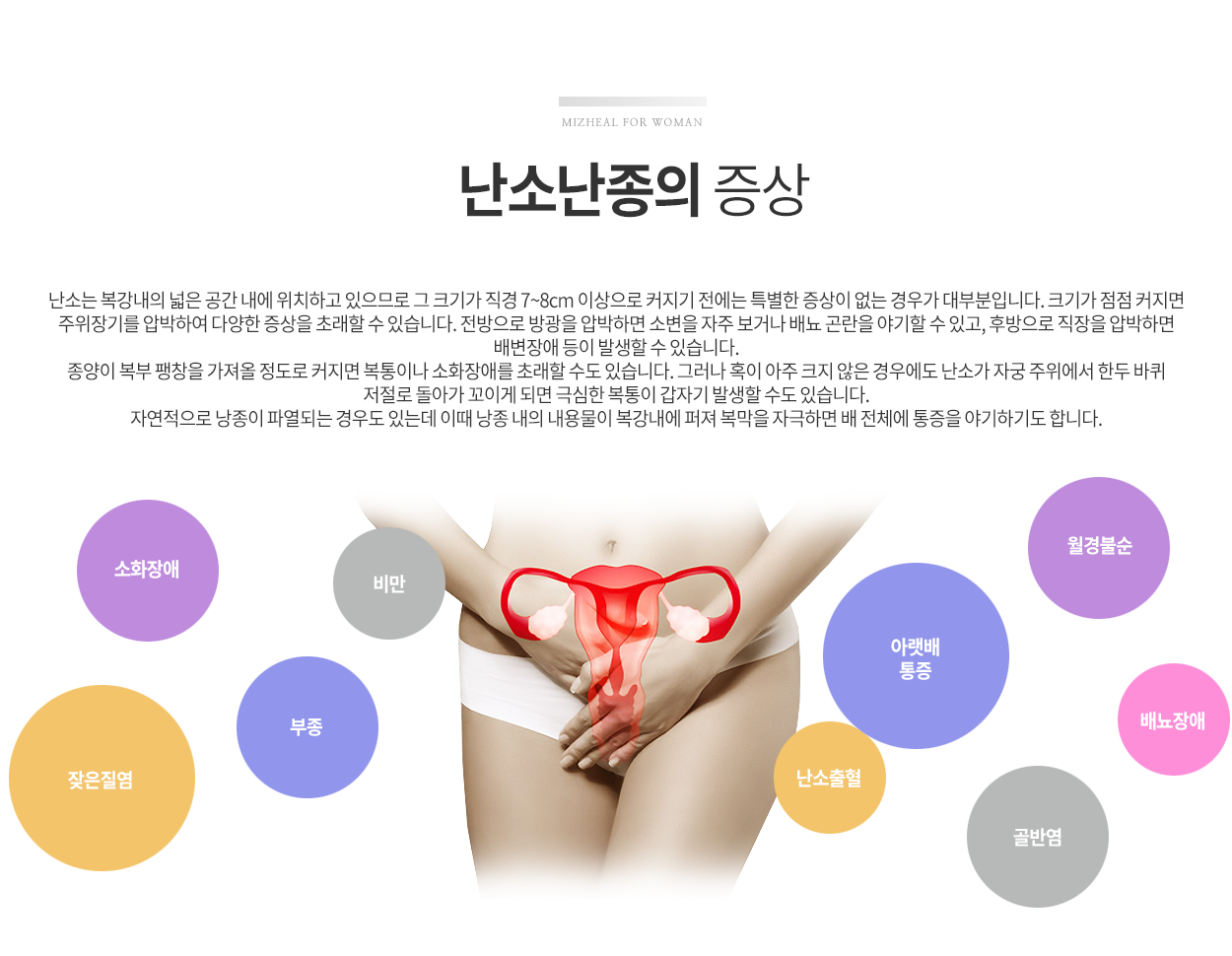 난소난종증상