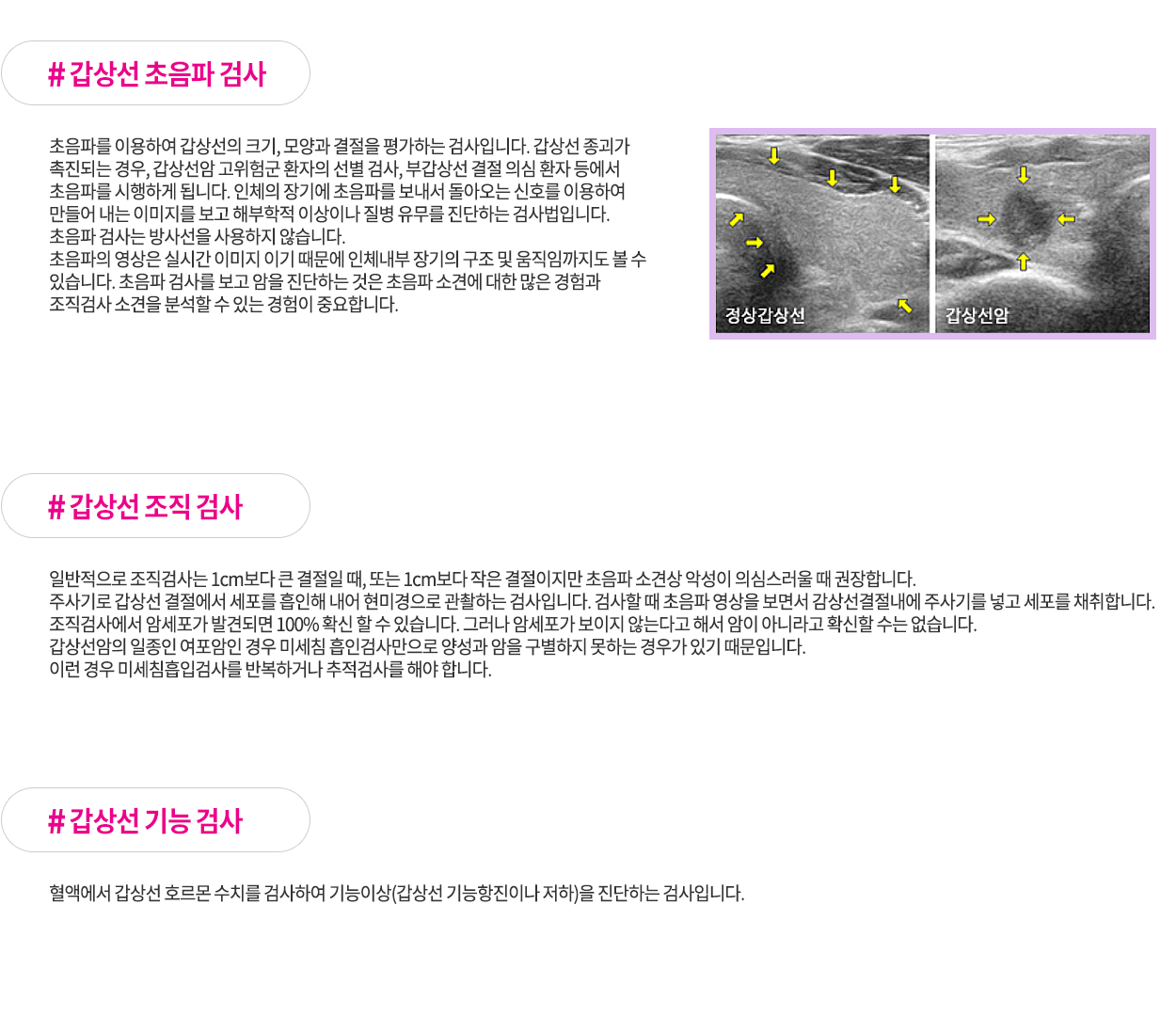 갑상선암진단