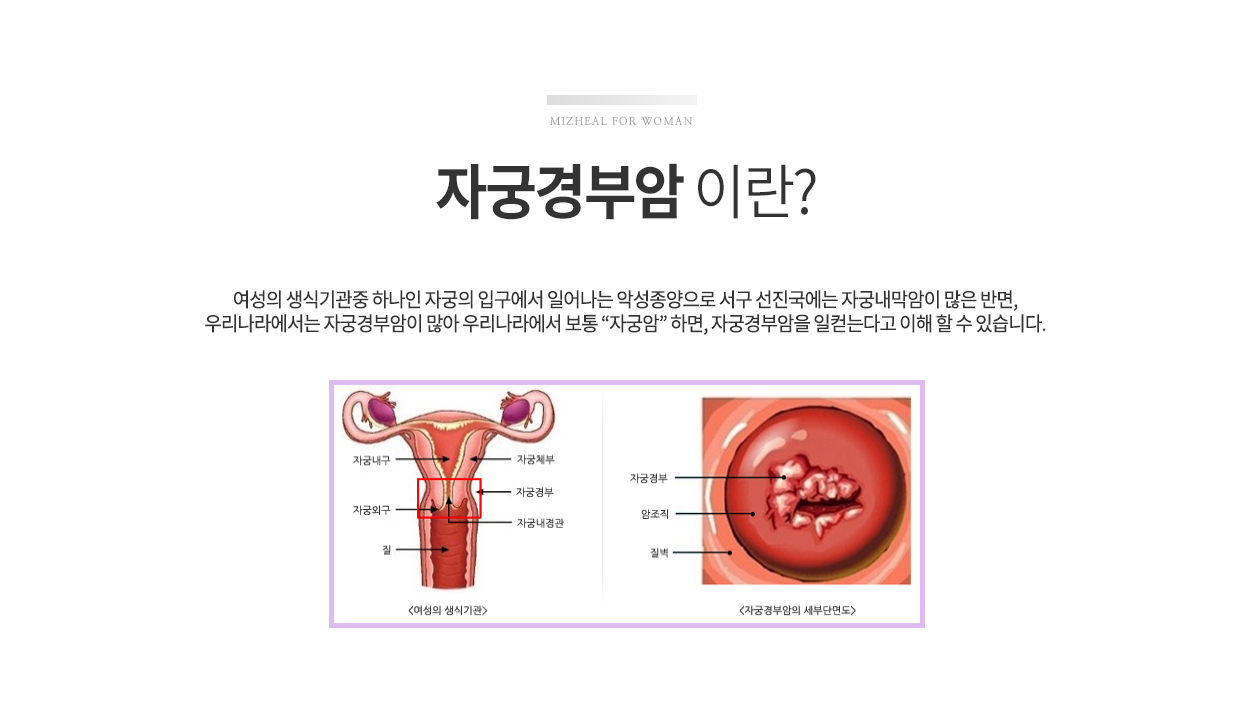 자궁경부암