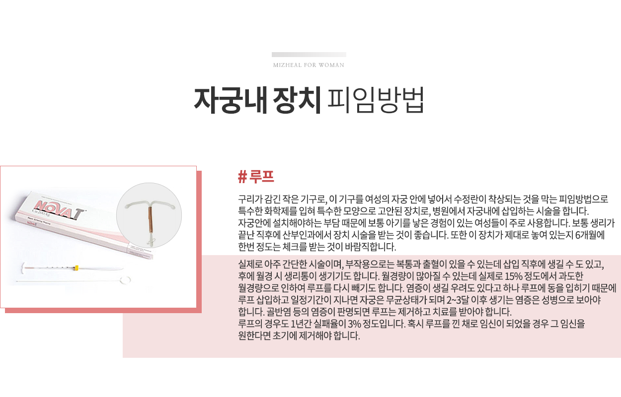 자궁내 장치 루프