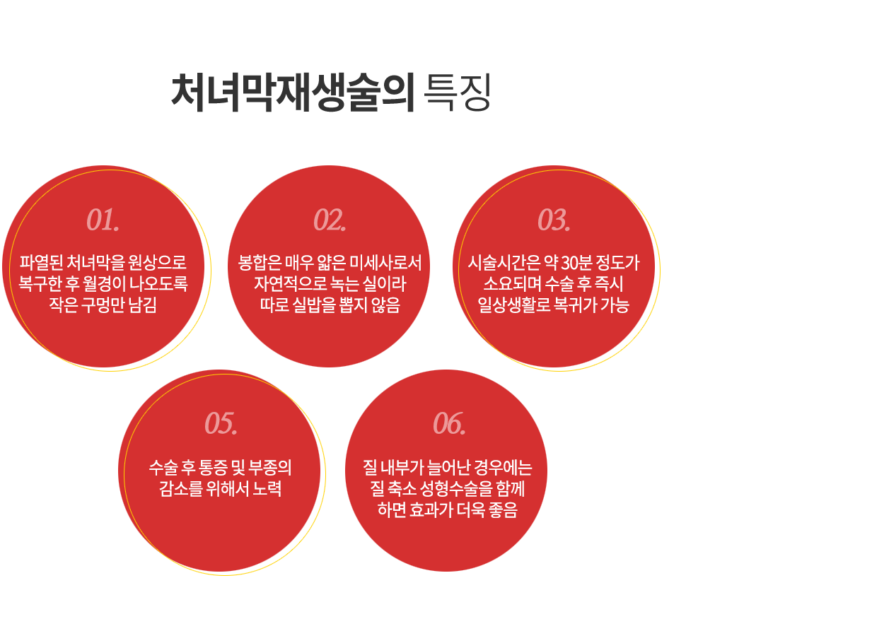 처녀막재생술특징